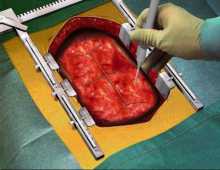 Virtual Surgeon: Open Heart
